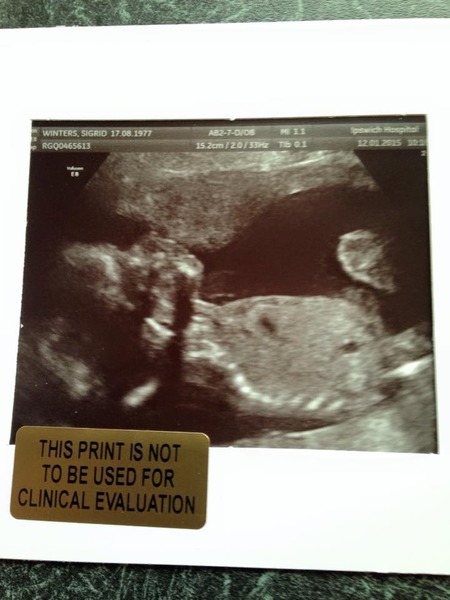Due June 1st 2015 - 20 week scan photo