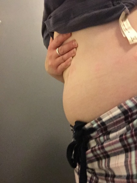 July 2015 - more and more beans are seen on scans