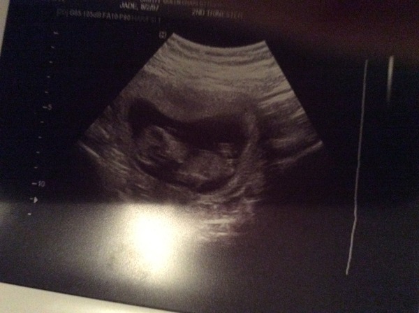 Gender guesses please!!
