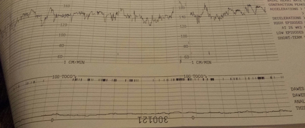 Movements checked but still worried
