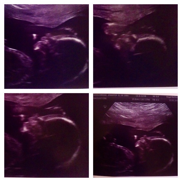 June 2015 - thread 7 - finding out our teams!! Pink/Blue/Yellow which are you?