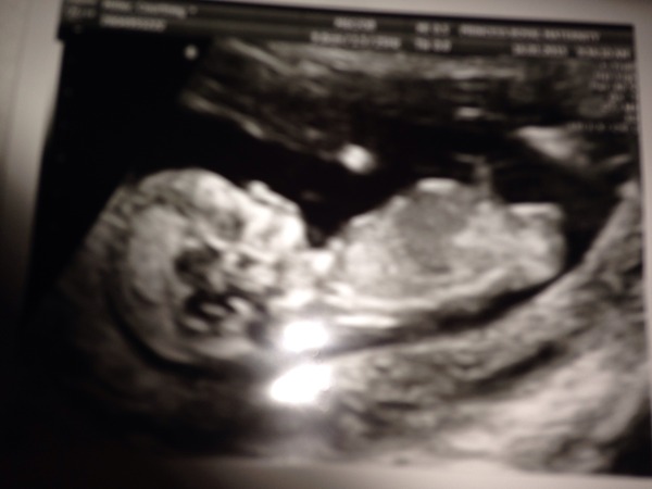 Gender guesses please!!