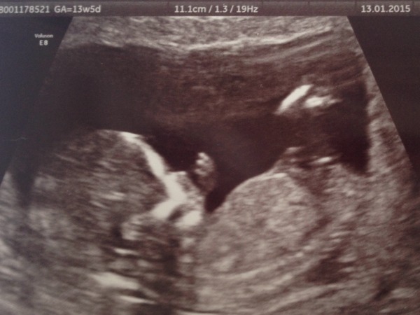 boy or girl