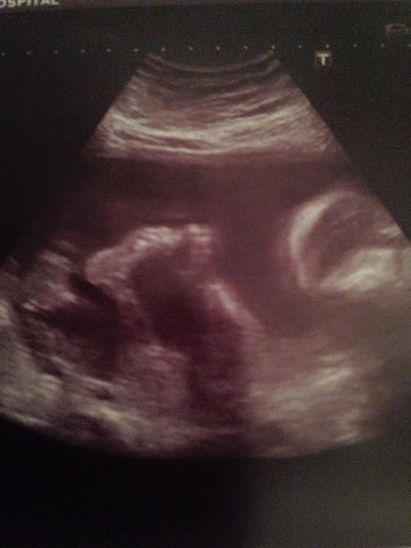 June 2015 - thread 7 - finding out our teams!! Pink/Blue/Yellow which are you?