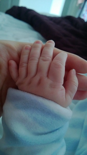 To remove/not remove my child's fingers