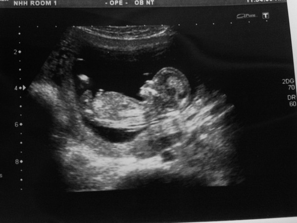 Rubbish at nub theory and skull shape - any guesses welcome