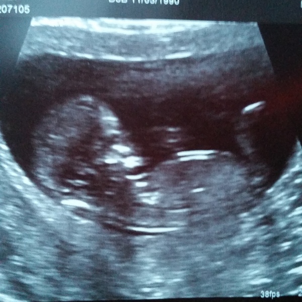 Boy or girl nub? just for fun