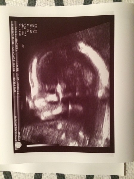 June 2015 - thread 7 - finding out our teams!! Pink/Blue/Yellow which are you?