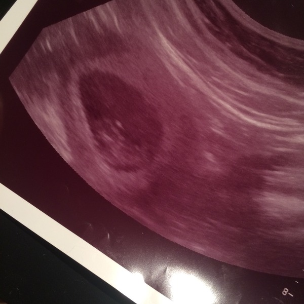 September 2015 (#3) bring on the scans as our waists expand!