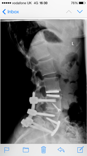 July 2015 - the thread in which bumps really start to appear...