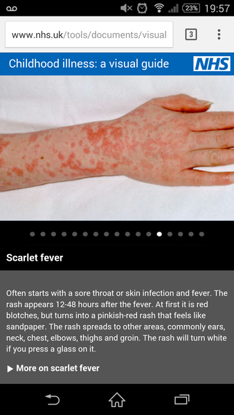 Does my toddler have scarlet fever?