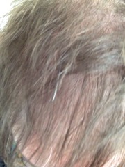 The hair, the hair....