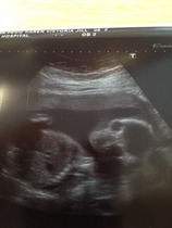 June 2015 - bumps ahoy!