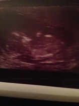 4D/ gender scan on Tuesday - so excited! Guesses in meantime?