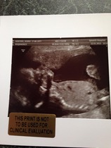 Due June 1st 2015 - 20 week scan photo
