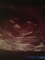 4D/ gender scan on Tuesday - so excited! Guesses in meantime?
