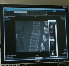 The Back Pain Emporium, Internet Shopping, Drugs and Dealing with Doctors. Thread 6.
