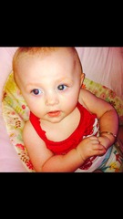 Should I worry retinoblastoma ?