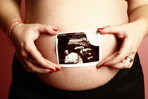 The posifrickintivity continues... another shiny and new posifrickintivity thread for pregnancy after miscarriage