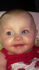 Should I worry retinoblastoma ?