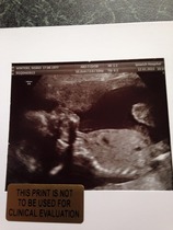 Due June 1st 2015 - 20 week scan photo