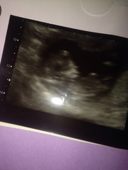 Nub, skull gender guesses?..