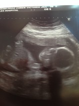 June 2015 - bumps ahoy!