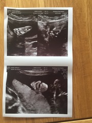 May 2015 - thread 5 - yellow, pink or blue, which team are you?