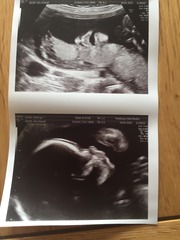 June 2015 - thread 7 - finding out our teams!! Pink/Blue/Yellow which are you?