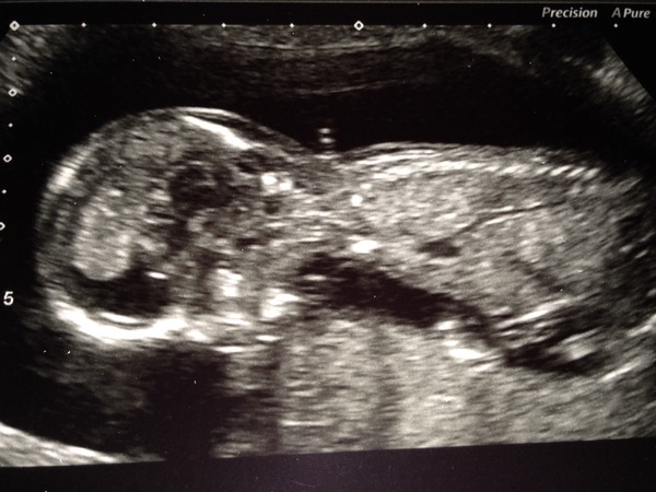 Opinions on skull theory and its accuracy please x