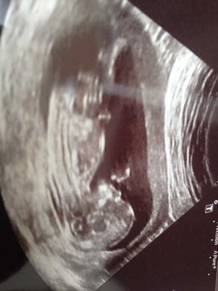 September 2015 (Thread 5) Bring on the scans! :)