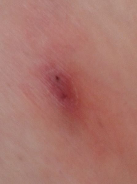 What's your best sporn story?