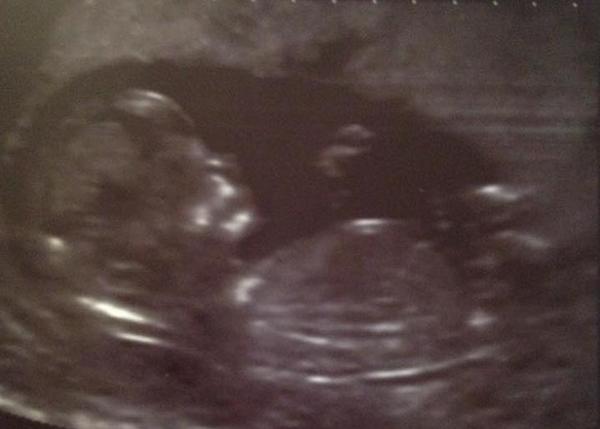 September 2015 (Thread 4) Boobs are growing, but we're not yet showing!