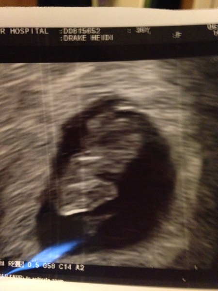 September 2015 (Thread 4) Boobs are growing, but we're not yet showing!