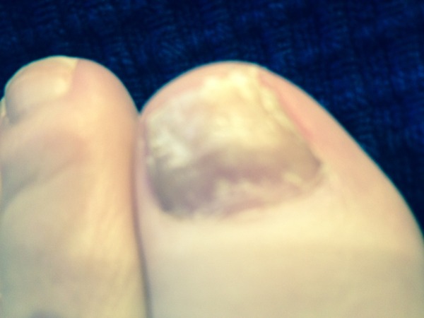 Why are my nails like this?