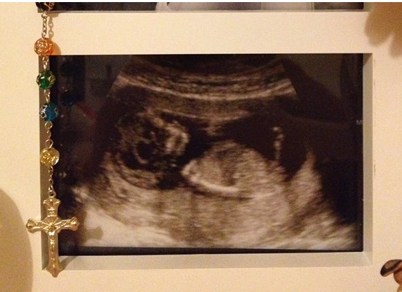 September 2015 (Thread 4) Boobs are growing, but we're not yet showing!