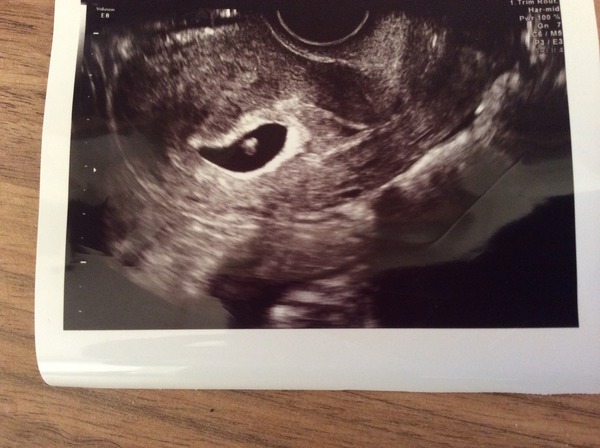 September 2015 (Thread 4) Boobs are growing, but we're not yet showing!