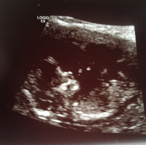 September 2015 (Thread 5) Bring on the scans! :)