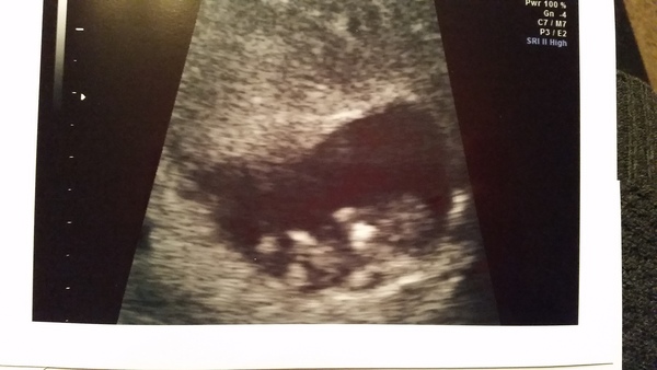 September 2015 (Thread 5) Bring on the scans! :)