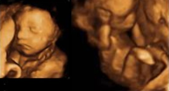 May 2015 - thread 6 - third trimester, here we come!