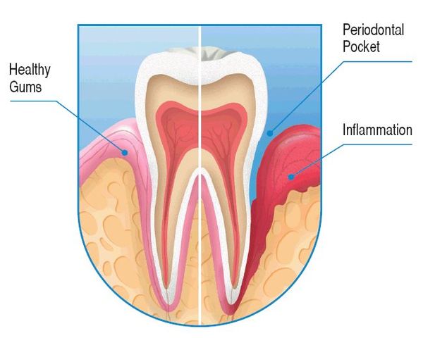 Dental Chronicles