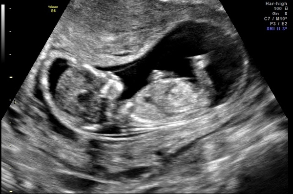 September 2015 (Thread 5) Bring on the scans! :)