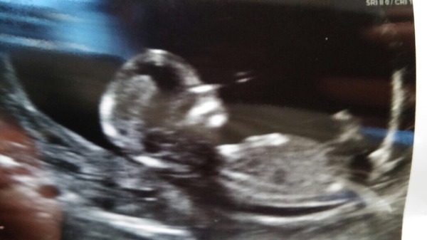 September 2015 (Thread 5) Bring on the scans! :)