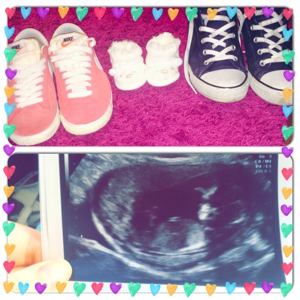 September 2015 (Thread 5) Bring on the scans! :)