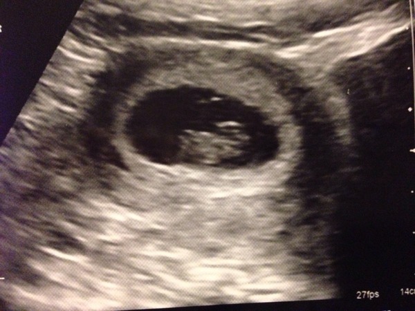 September 2015 (#3) bring on the scans as our waists expand!