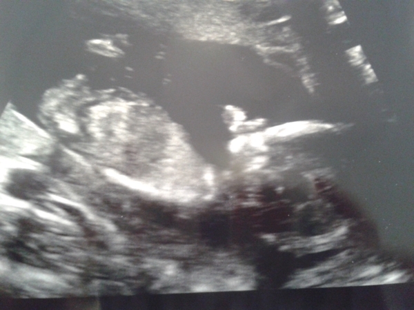 September 2015 (Thread 5) Bring on the scans! :)