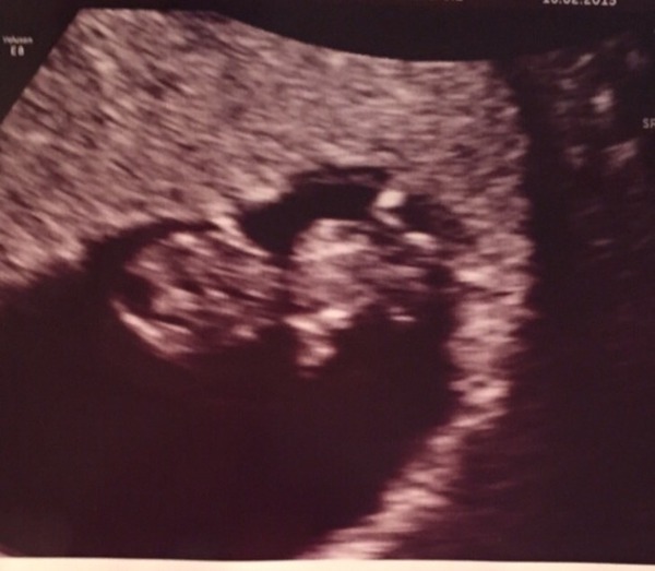 September 2015 (Thread 4) Boobs are growing, but we're not yet showing!