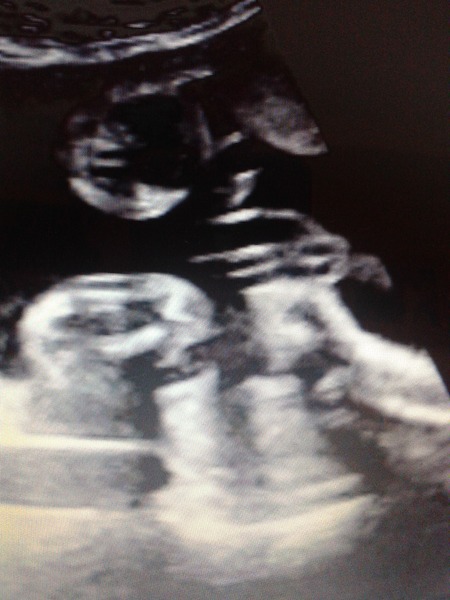 Have a guess-boy or girl