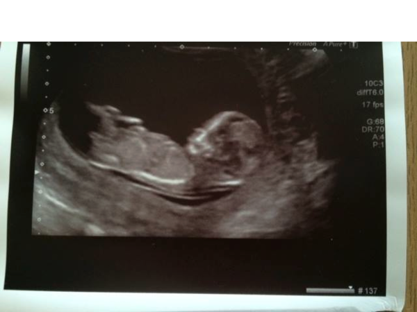 Boy or girl?