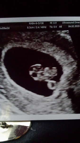 September 2015 (#3) bring on the scans as our waists expand!